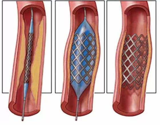 愛(ài)旺工業(yè)醫(yī)療行業(yè)設(shè)備案例